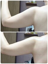 ラグーン(Lagoon)/WINBACK×筋膜リリース