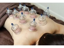 リラクゼーションサロン リリーヴ(Relieve)/吸い玉（カッピング）