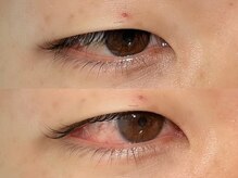 アイクイック 駒込店 巣鴨 王子(AiQuick)/まつげパーマ/逆さまつ毛矯正