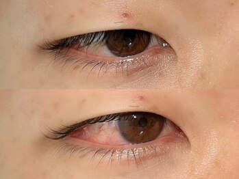 アイクイック 駒込店 巣鴨 王子(AiQuick)/まつげパーマ/逆さまつ毛矯正