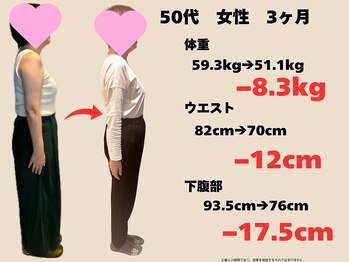 樹美容鍼灸整体院 烏丸御池/５０代 ３ヶ月コース