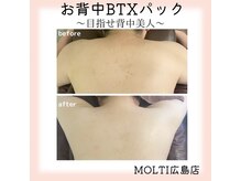モルティー 広島店(Molti)/ブライダルエステ