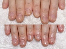 グラシナ 鳥丸店/(深爪/長さだし/フィルイン/)