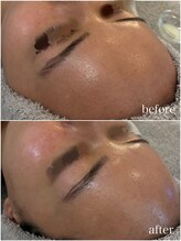 プレシア(Plecia)/ご新規様お得にララピール♪