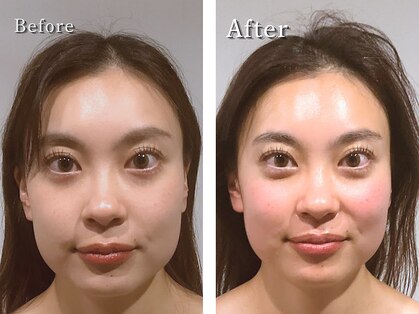 グレースフィオーレ 南越谷店(gracefiore)の写真