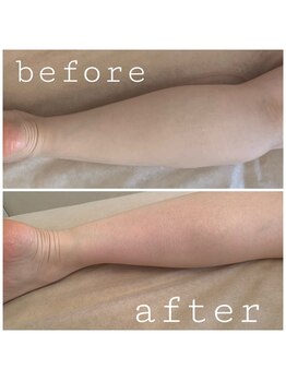 マリーゴールド(marigold)/一回の施術でむくみスッキリ