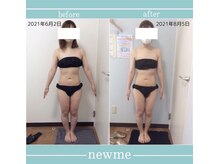ニュウミー 諏訪本店(newme)/お客様ビフォーアフター