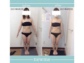 ニュウミー 諏訪本店(newme)/お客様ビフォーアフター