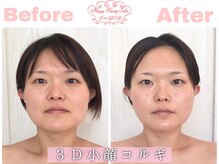 ハッピービューティーサロン じゆう(Happy Beauty Salon J∞YOU)の雰囲気（たった一度の施術で、こんなにも変化が！岡山/倉敷/小顔/コルギ）