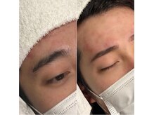 アンフルーヴ/アイブロウ(ワックス・パーマ)