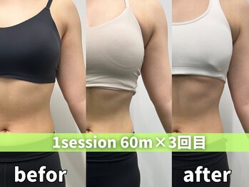 モア 札幌大通店(MORE)/北海道唯一クビレ協会資格保有