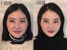 ミヌレ 大阪店(minulle)の雰囲気（自分史上最高の小顔へ！即効性抜群。顔の根本から整えます。）