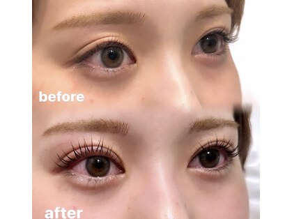 エレン(ELEN)の写真
