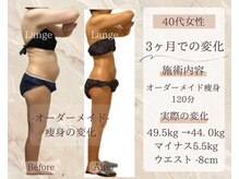 サロン ド ボーテ ラーンジュ 岐阜店(salon de beaut'e L'ange)/ハイパ-ナイフEX2ダイエット痩身