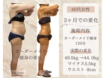 サロン ド ボーテ ラーンジュ 岐阜店(salon de beaut'e L'ange)/ハイパ-ナイフEX2ダイエット痩身