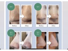 ティエラ(Tierra)の雰囲気(ハイドラフェイシャル/角栓黒ずみ毛穴ケア/小顔リンパケア)