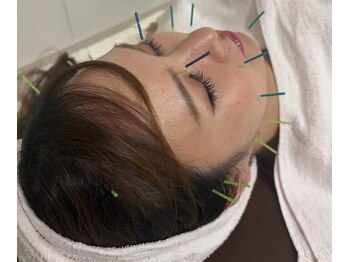 リアン(Re.庵)の写真/【姪浜で鍼灸を受けるならRe.庵】つぼのプロ鍼灸師担当！満足度高い美容鍼に首肩や腰のつらさに体の鍼灸♪