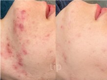 ポ ワール(Poir)/