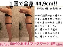 アメリイ 百合ヶ丘 新百合ヶ丘(Amerii)/【50代痩身】1回全身-44.9cm痩せ