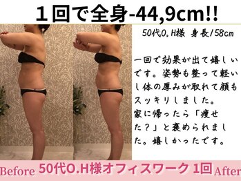 アメリイ 百合ヶ丘 新百合ヶ丘(Amerii)/【50代痩身】1回全身-44.9cm痩せ