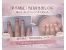 美爪育成深爪矯正長さだしコース