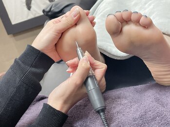 ゾゾ イリプレッセブル(ZOZO irreplaceable)/魚の目、タコ除去