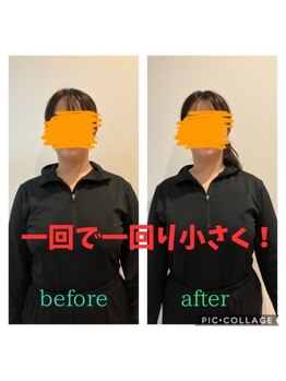 ヨサパーク リープ(YOSA PARK Leap)/プレミアムコースのbefore after