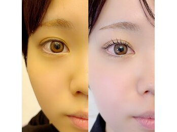 グロウビューティー(grow beauty)/