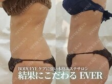エヴァーグレース 河原町店