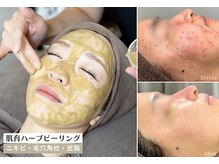スリースリー 恵比寿(THREE THREE)の雰囲気（【肌育ハーブピーリング】繰り返すニキビ・毛穴・皮脂が多い方に）