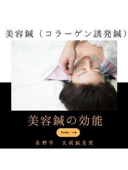 天照鍼灸接骨院/美容鍼で小顔効果を実感できる