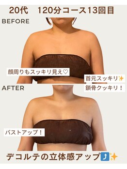 リウル(RiUll)/デコルテスッキリ鎖骨くっきり！