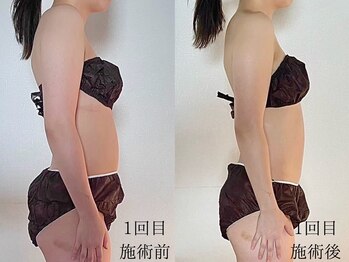 メリア 翠町店(Melia)/全身リンパで姿勢改善にも◎