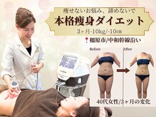 ベルホワイト(Belle White)