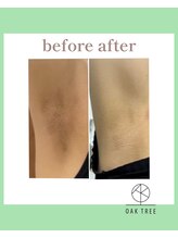 オークツリー(oak tree)/Before After