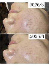 ブラックボックス(BLACK BOX)/20代男性のお客様