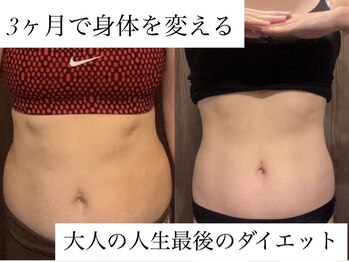 ジョーヌ(JAUNE)の写真/《圧倒的効果！》年齢を重ねる毎に、なかなか痩せない。そんな大人女性のためのセル脂肪分解マッサージ。