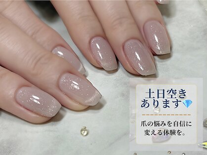 アルムネイル(ARUM nail)の写真