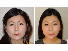 アゴラ/【小顔】豊富な施術実績有り