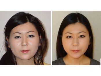 アゴラ/【小顔】豊富な施術実績有り