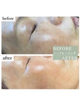 ビューティーサロン エー(A)/ハーブ〈ビフォーアフター〉