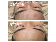 ラクシー 北千住(luxssy)/シェービング×眉パーマ、wax