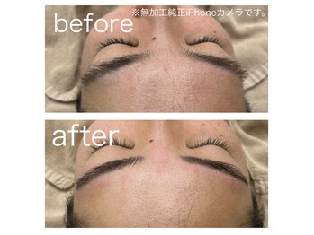 ラクシー 北千住(luxssy)/シェービング×眉パーマ、wax