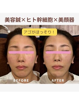 ベルソー鍼灸整体院(berceau鍼灸整体院)/