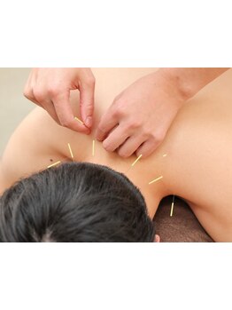 鍼灸施術を受けたい