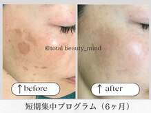 トータルビューティー マインド(Total Beauty)