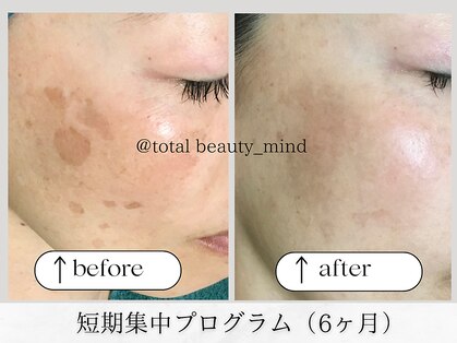 トータルビューティー マインド(Total Beauty)の写真