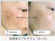 トータルビューティー マインド(Total Beauty)の写真