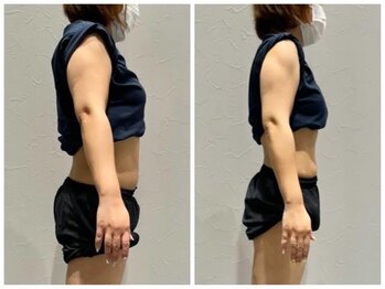 ストルツ(STOLZ)/3ヶ月で8キロの減量に成功!