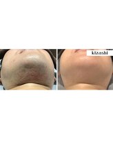 キザシ(kizashi)/パパの頬っぺた触れたくなる